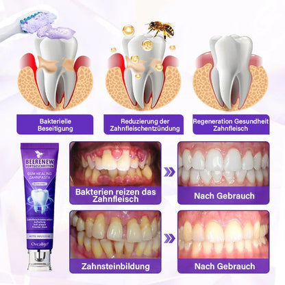 Oveallgo® BeeRenew Zahnpasta für fortgeschrittene Zahnfleischheilung