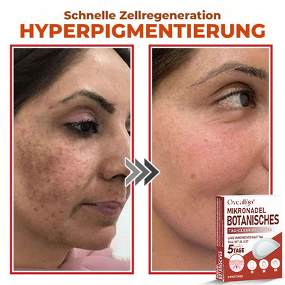 Oveallgo® MikroNadel Botanisches Tag-Clear-Pflaster Pro 🇩🇪 Hergestellt in der Germany