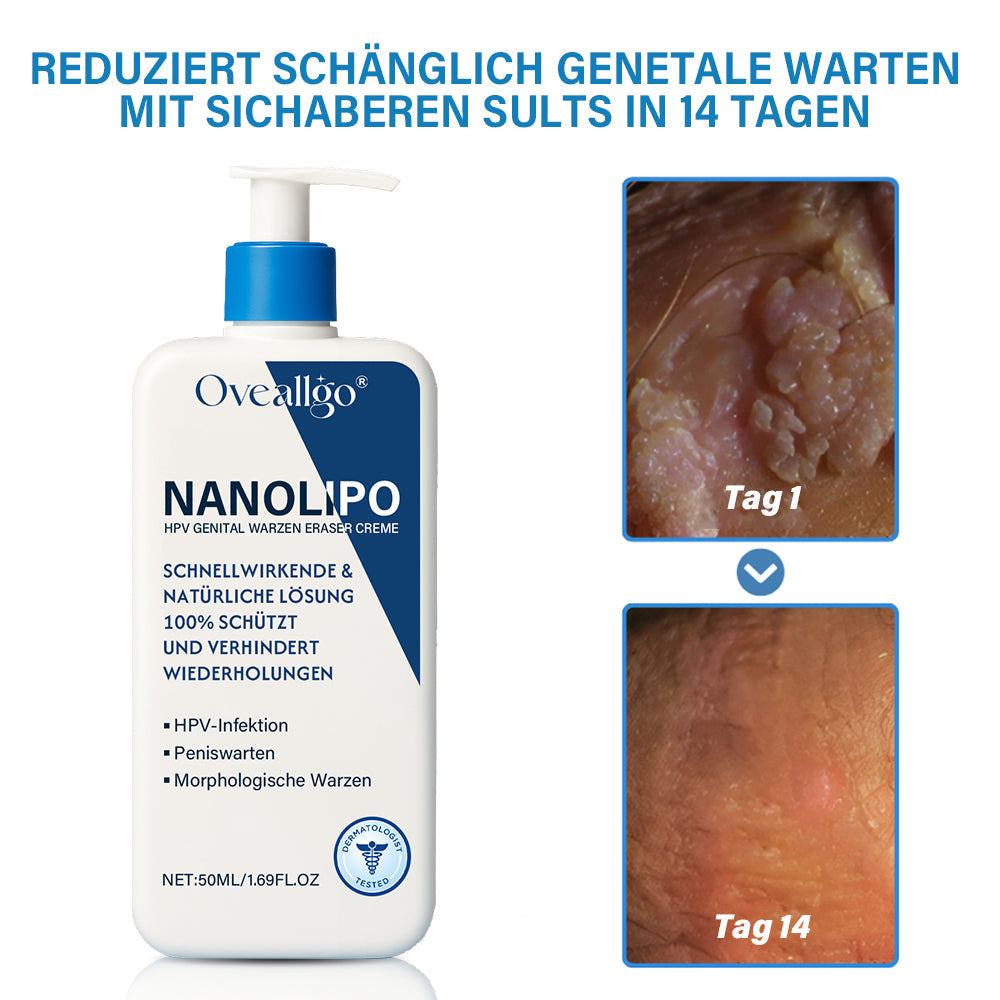 Oveallgo® NanoLipo HPV Genital warzen-Eraser creme