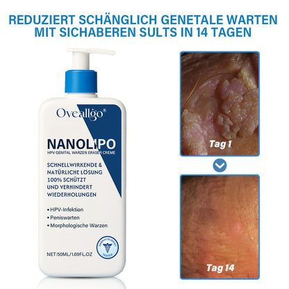 Oveallgo® NanoLipo HPV Genital warzen-Eraser creme Promax