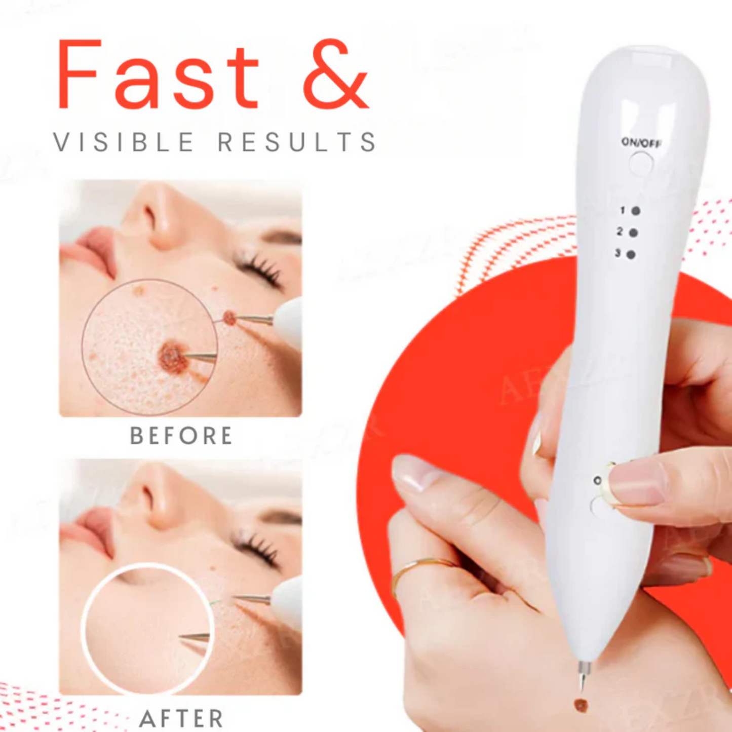 Bikenda® Portable Skin Care Laser Pen