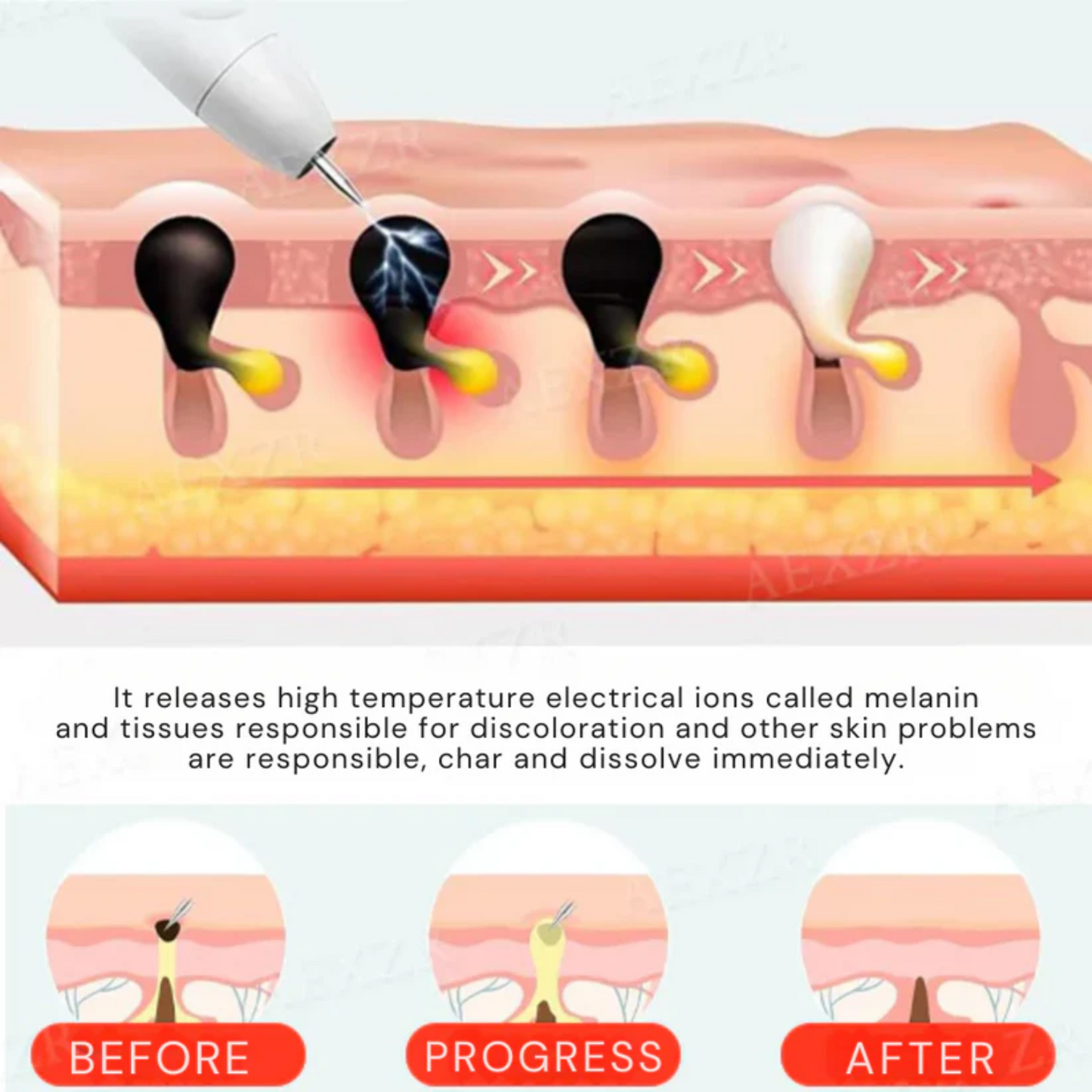 Bikenda® Portable Skin Care Laser Pen
