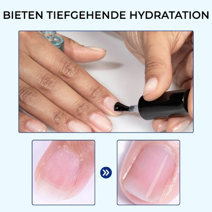 Oveallgo® OnyxoGuard Wachstum der Nägel und Reparaturserum