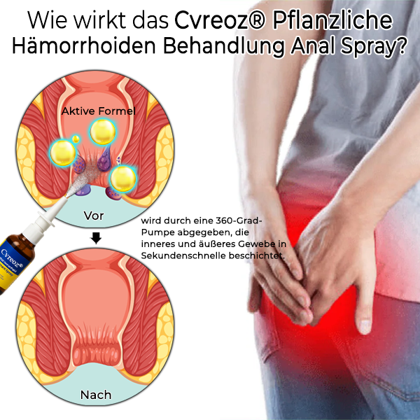Cvreoz® Pflanzliche Hämorrhoiden Behandlung Anal Spray
