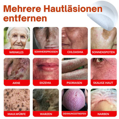 Oveallgo® MikroNadel Botanisches Tag-Clear-Pflaster Pro 🇩🇪 Hergestellt in der Germany