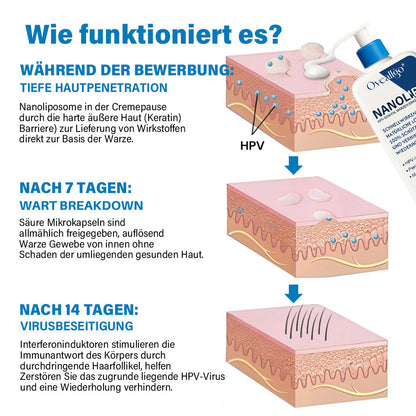 Oveallgo® NanoLipo HPV Genital warzen-Eraser creme Promax
