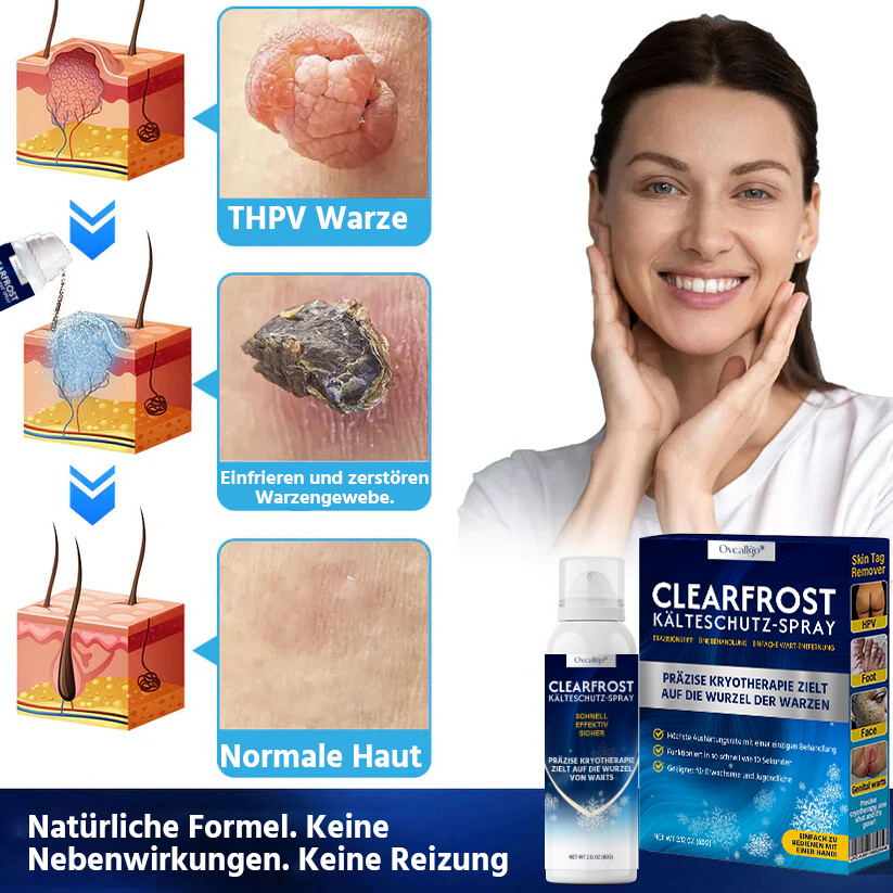 Oveallgo® ClearFrost Kälteschutz-Spray