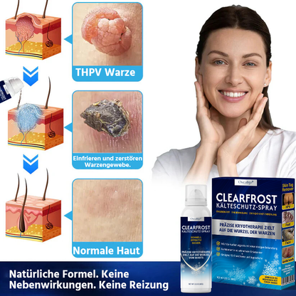 Oveallgo® ClearFrost Kälteschutz-Spray