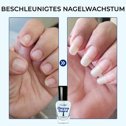 Oveallgo® OnyxoGuard Wachstum der Nägel und Reparaturserum