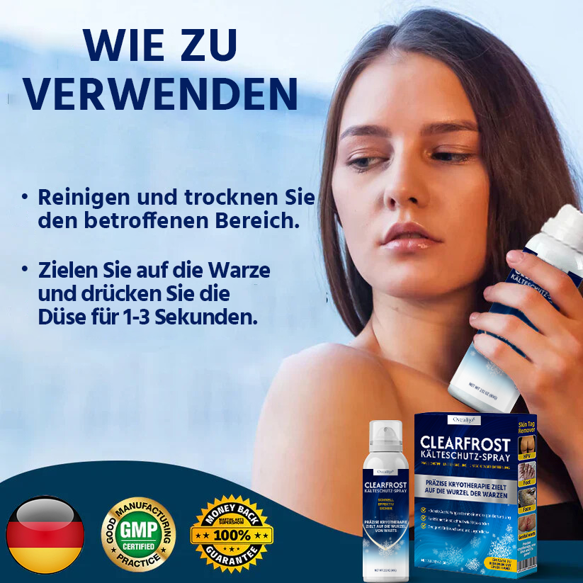 Oveallgo® ClearFrost Kälteschutz-Spray Pro