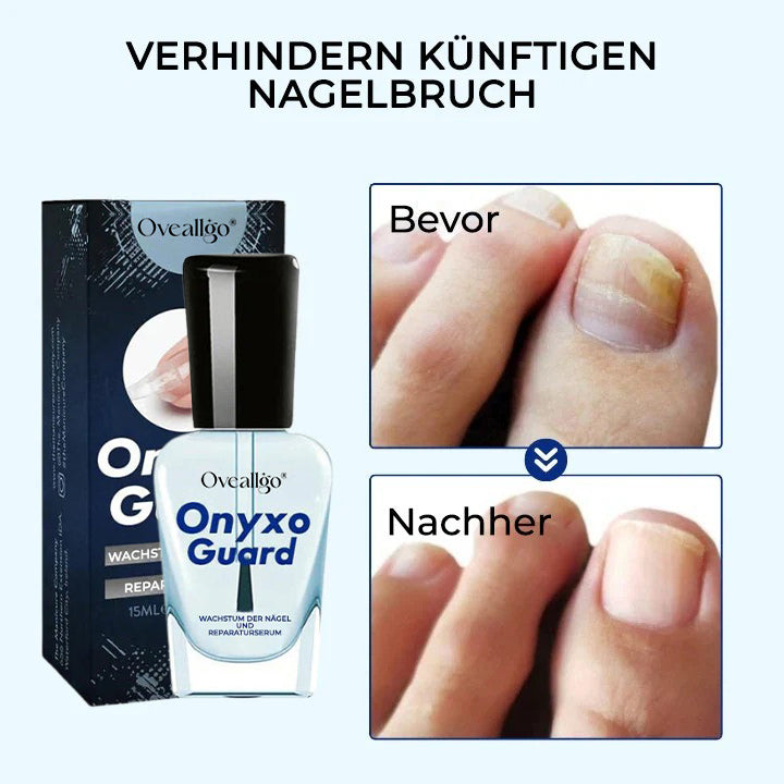 Oveallgo® OnyxoGuard Wachstum der Nägel und Reparaturserum