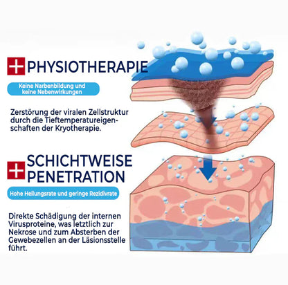 Oveallgo® ClearFrost Kälteschutz-Spray