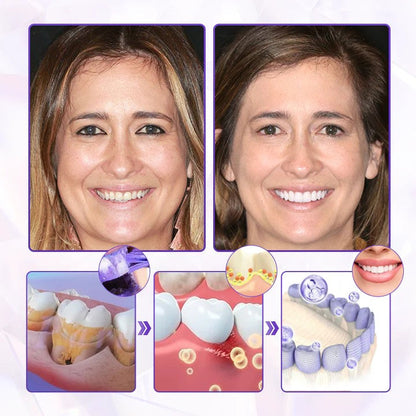 Oveallgo® BeeRenew Zahnpasta für fortgeschrittene Zahnfleischheilung