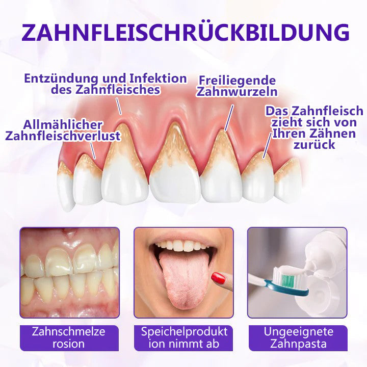 Oveallgo® BeeRenew Zahnpasta für fortgeschrittene Zahnfleischheilung