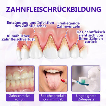 Oveallgo® BeeRenew Zahnpasta für fortgeschrittene Zahnfleischheilung