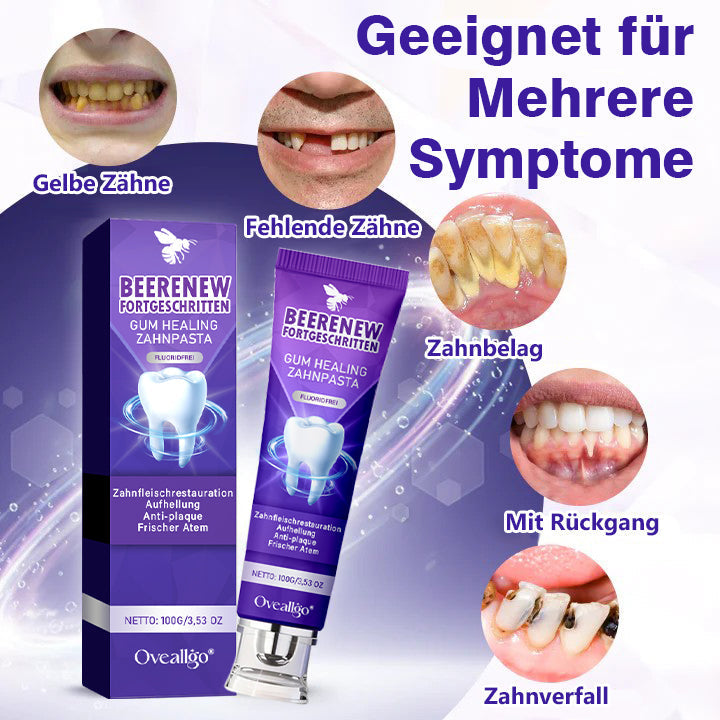 Oveallgo® BeeRenew Zahnpasta für fortgeschrittene Zahnfleischheilung