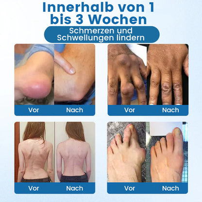 Oveallgo® BPC-157 Gelenk‑Repair‑Creme