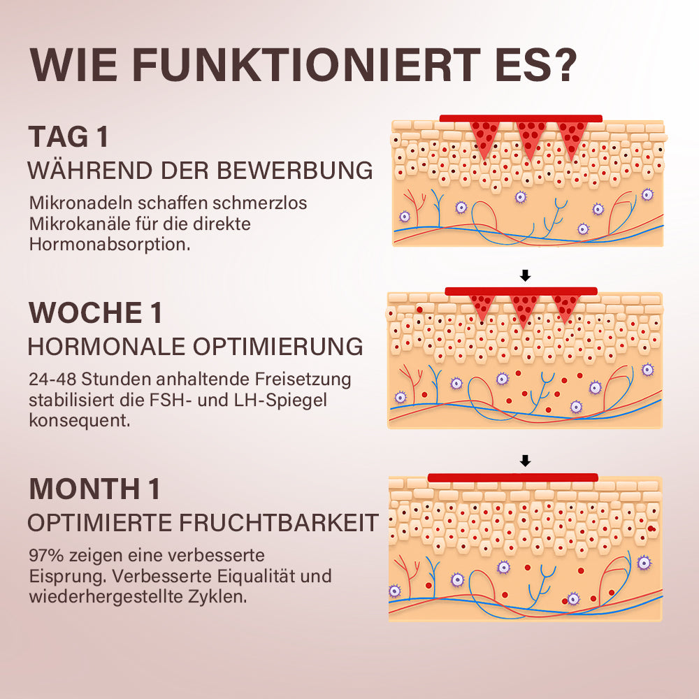 Oveallgo® FertiliPatch Mikronadel-System zur Steigerung der Fruchtbarkeit PRO