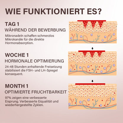 Oveallgo® FertiliPatch Mikronadel-System zur Steigerung der Fruchtbarkeit PRO