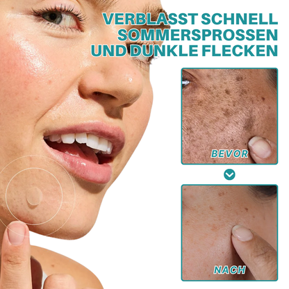 Fivfivgo® Botanisch Sommersprossen & Fleck Entfernungs-Patch
