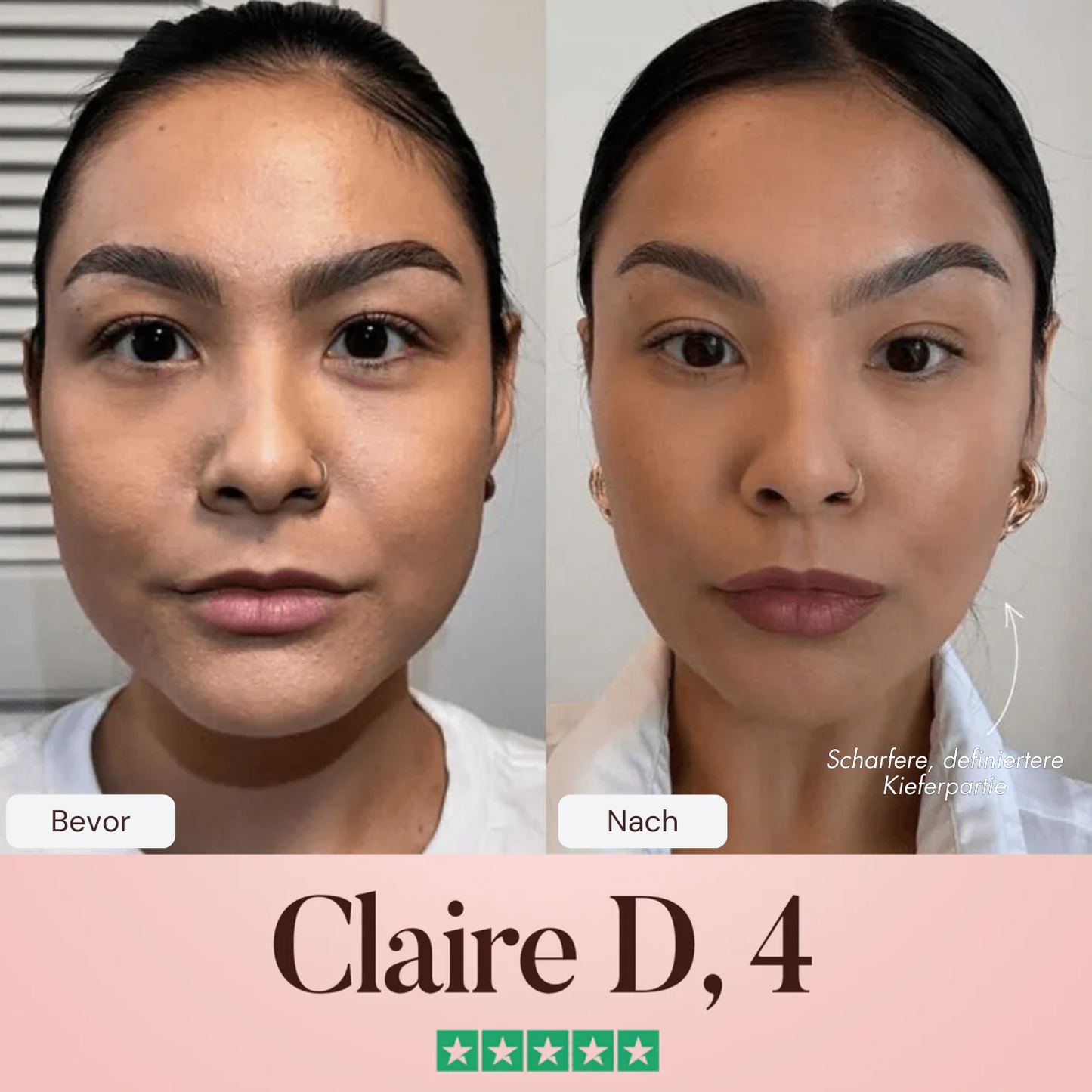 Oveallgo® SculptFix Maske Infundiert mit Retinol und Kollagen um Ihre beste Kieferpartie zu enthüllen