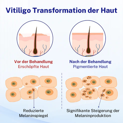 Oveallgo® Evenora Kräuterspray